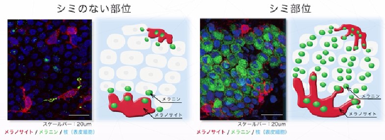 メラノショット W 効果